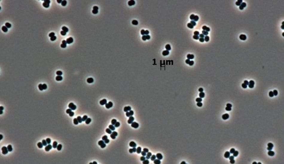 Sobrevivência Microbe