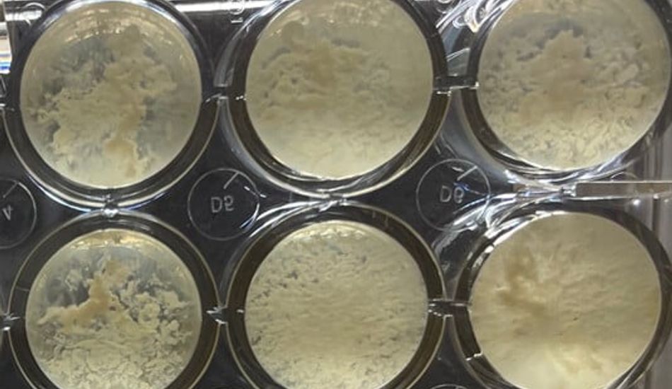 imageSobrevivência Microbe