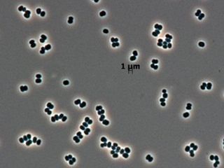 thumbnail - Sobrevivência Microbe